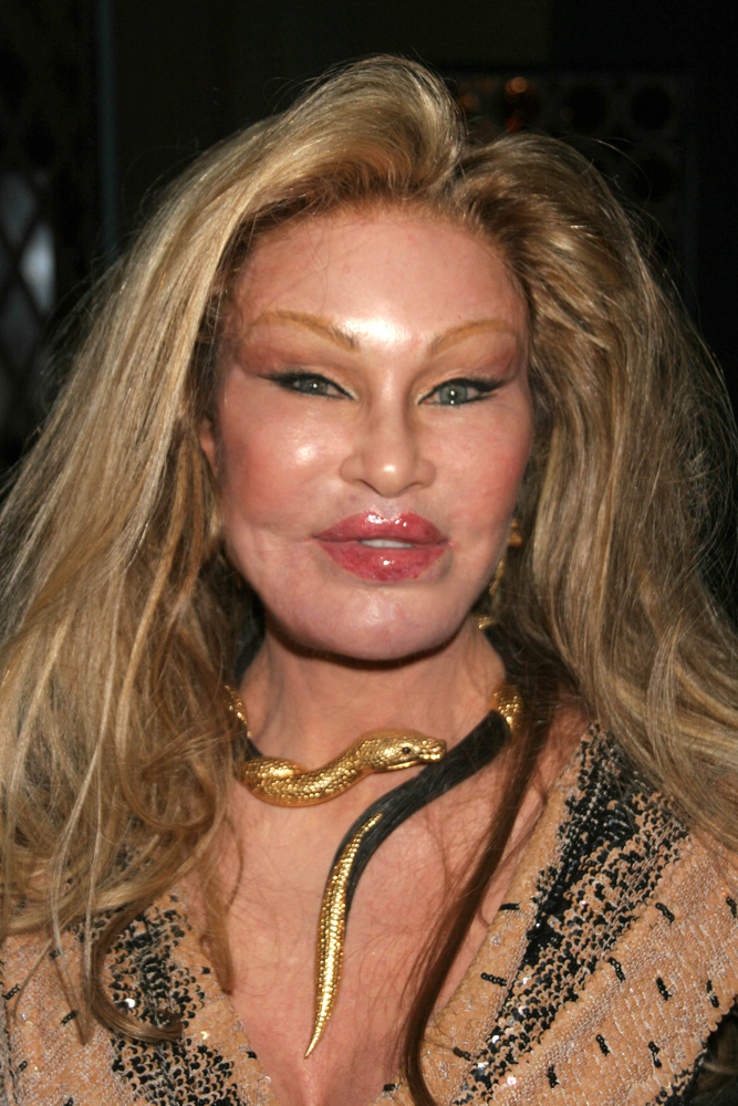 JocelynWildenstein